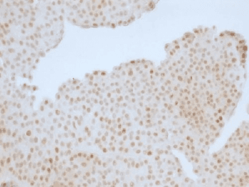 RB1 / Retinoblastoma / RB Antibody (clone RB1/1754)