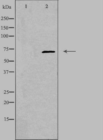 TROVE2 Antibody
