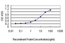 Monoclonal Mouse anti-Human P3H1 / LEPRE1 Antibody (clone 3C7, IHC, IF, WB)