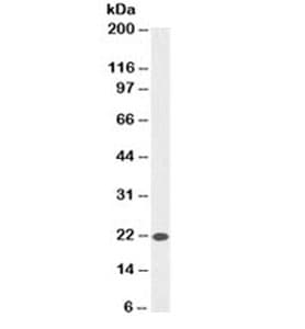 BAX Antibody (aa3-16, clone SPM336)