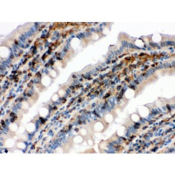 CFL1 / Cofilin Antibody (aa122-152)