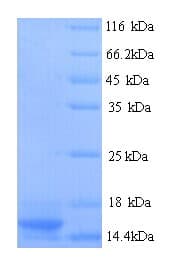 Rat PTMA / Prothymosin Alpha Protein (Recombinant His)