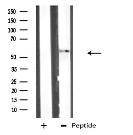 ATG4D Antibody