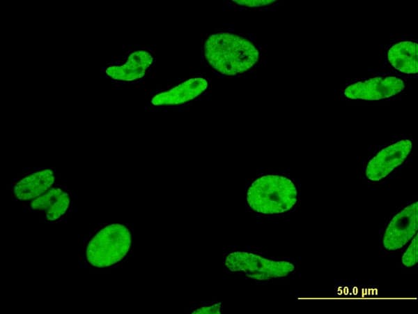 Monoclonal Mouse anti-Human HNRPA1 / HnRNP A1 Antibody (clone 2E6, IF, WB)