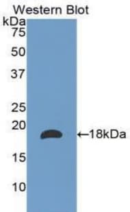 LAMA1 / Laminin Alpha 1 Antibody (aa886-1039)