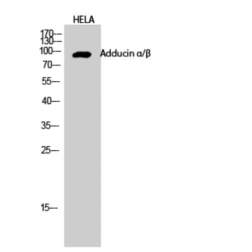 ADD1 + ADD2 Antibody (670-750 aa)