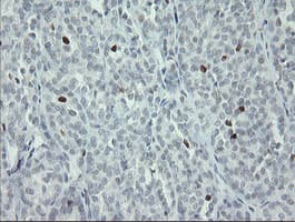 MAFB Antibody (aa32-320, clone OTI1E9)