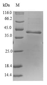 Human RPP25L / C9orf23 Protein (Recombinant GST, N-terminus)