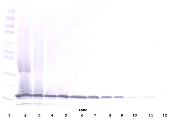 IHC-plus™ Polyclonal Rabbit anti-Human MDK / Midkine Antibody (IHC, WB)