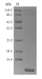 Pandinus imperator Pandinin-2 Protein (Recombinant 6His, N-terminus)