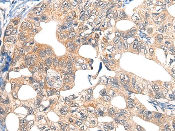 Polyclonal Rabbit anti-Human EPHA6 / EPH Receptor A6 Antibody (IHC, WB)