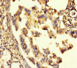 Polyclonal Rabbit anti-Human GABRA6 Antibody