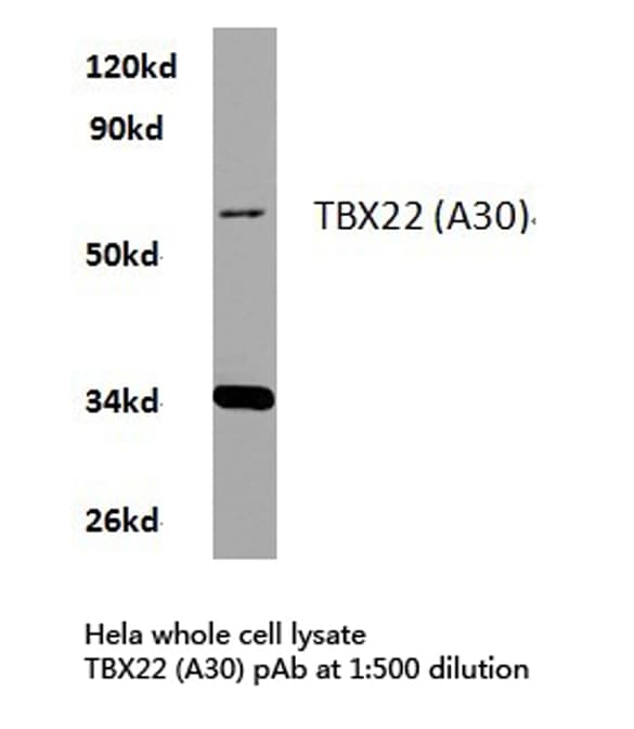 TBX22 Antibody (Ala30)