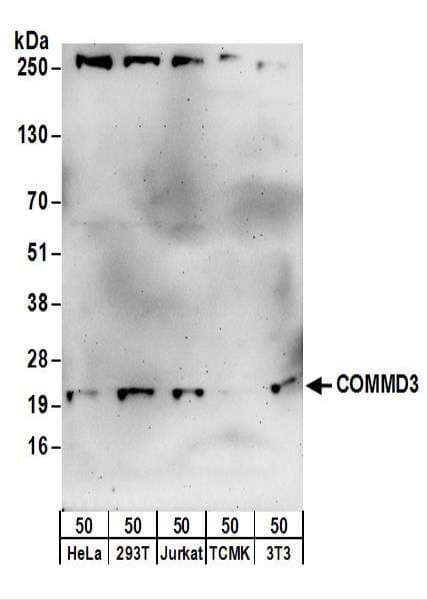 COMMD3 / BUP Antibody (aa145-195)