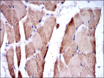 TNNI2 Antibody (clone 2F12A8)