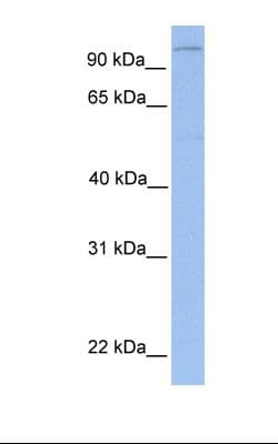 LPIN1 / Lipin 1 Antibody (aa218-267)