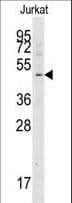 ATG4A Antibody (aa363-392)