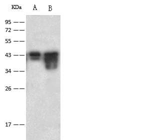 CAMK1 / CAMKI Antibody (Preservative Free)