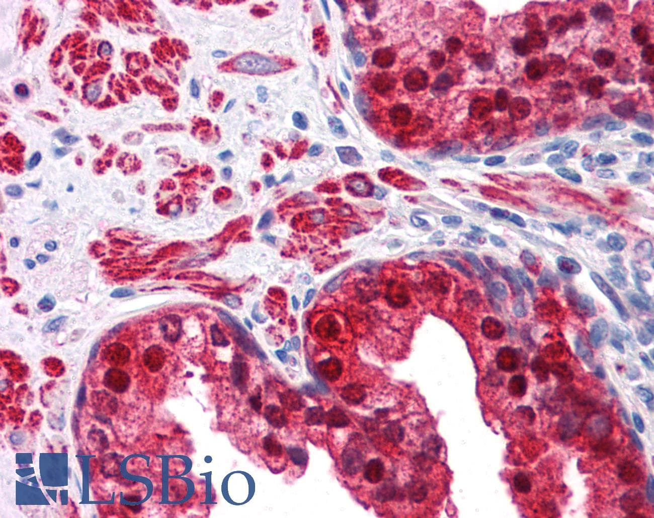PathPlus™ IDH1 / IDH Antibody
