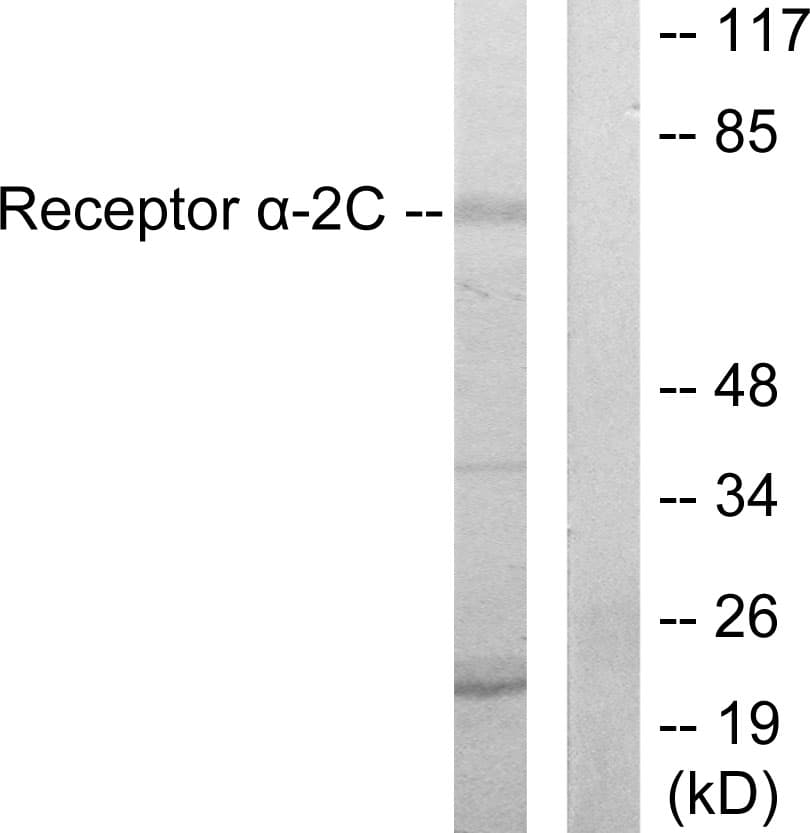 IHC-plus™ Polyclonal Rabbit anti-Human ADRA2C Antibody (aa336-385, IHC, WB)