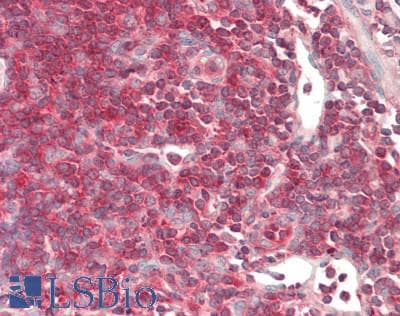 IHC-plus™ SLK Antibody (C-Terminus)