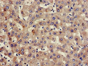 HPX / Hemopexin Antibody