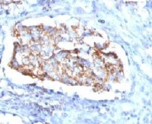 HSPD1 / HSP60 Antibody (clone SRPR60)