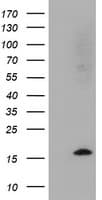 Cystatin SA / CST2 Antibody (clone OTI5C2)