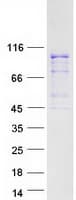 Human TFIP11 Protein (Recombinant Myc-DDK (Flag))