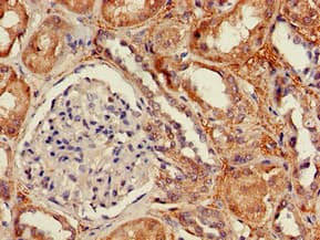 Polyclonal Rabbit anti-Human DPYSL4 / CRMP3 Antibody (IHC, IF)
