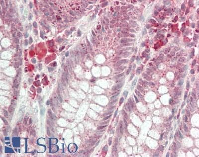 IHC-plus™ HOXA1 Antibody (Internal)