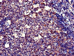 POLH / DNA Polymerase Eta Antibody