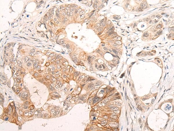 HTRA1 Antibody