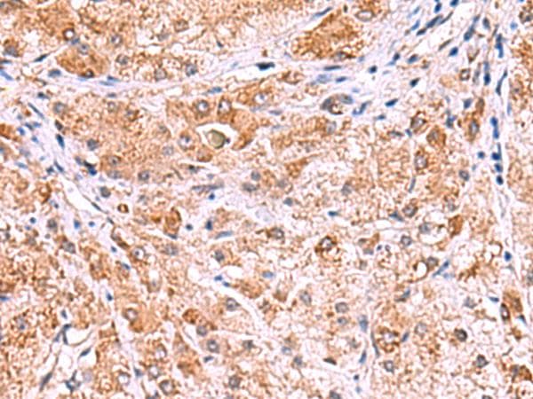 UXS1 Antibody