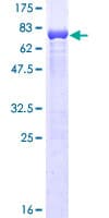 Human ABLIM1 Protein (Recombinant GST)