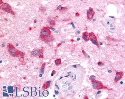 PathPlus™ OR6N1 Antibody (Extracellular Domain)