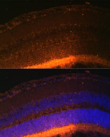 Rhodopsin Kinase / GRK1 Antibody