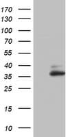 OTC Antibody (aa33-354, clone OTI5H8)