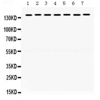 SMC3 / HCAP Antibody (aa1178-1216)