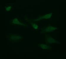 LGALS3 / Galectin 3 Antibody (clone OTI1A2)