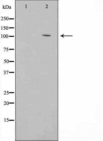 Polyclonal Rabbit anti-Human CDH1 / E Cadherin Antibody (IHC, IF, WB)