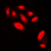 AR / Androgen Receptor Antibody (Internal)