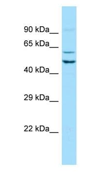 SEC62 / TP-1 Antibody (aa101-150)