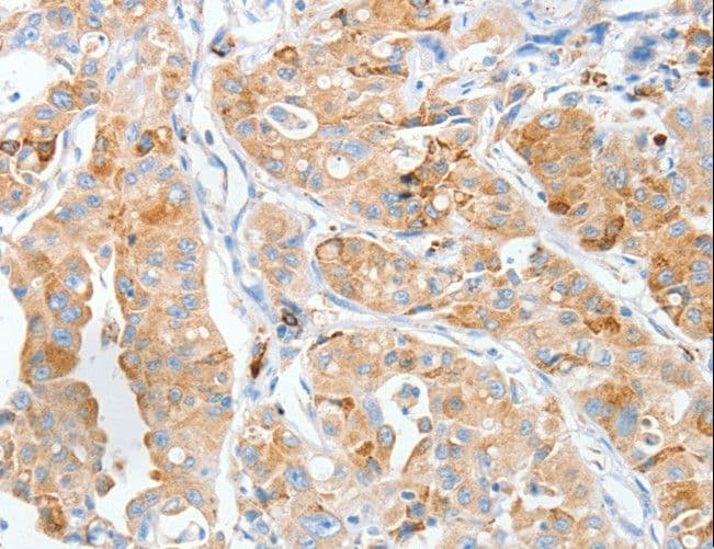 MANF / ARMET Antibody