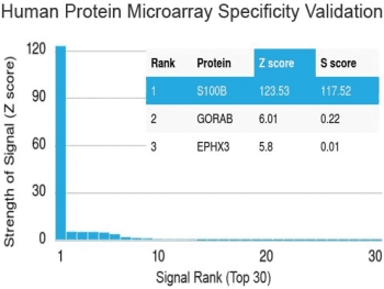 S100B / S100 Beta Antibody (clone S100B/1012, Ready-to-Use)
