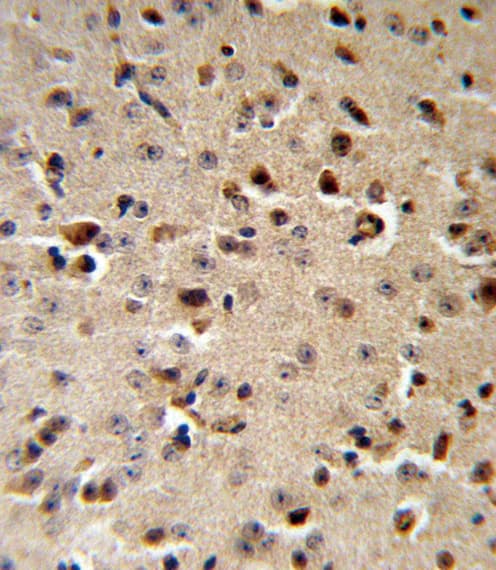 Polyclonal Rabbit anti-Human TPH2 Antibody (aa168-193, IHC, WB)