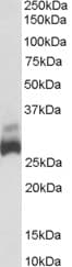PathPlus™ Polyclonal Goat anti-Human SDHB Antibody (aa271-280, IHC, WB)