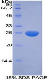 Human CFC1 Protein (Recombinant His-T7)