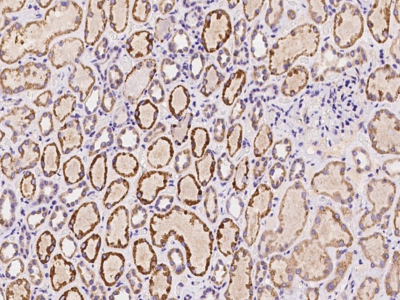 SPANXN4 Antibody