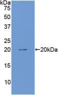 ANGPT1 / Angiopoietin-1 Antibody (aa253-429, FITC)